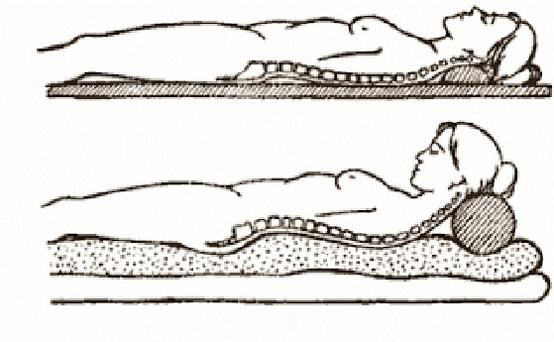 Osteochondrose